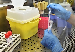 Coronavirus, il Friuli dichiara lo stato di emergenza