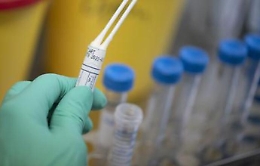 Coronavirus, rinviata la sfida tra l'Akragas e il Cus Palermo