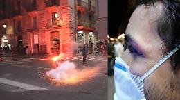 Cameraman ferito durante disordini a Catania contro Dpcm
