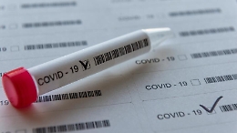 Presunto boss di Altavilla Milicia muore di covid ai domiciliari