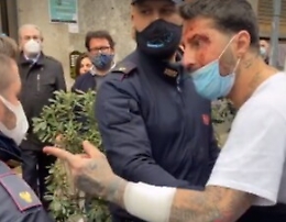 Fabrizio Corona ricoverato in psichiatria dopo aver spaccato vetro di ambulanza