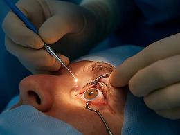 Cataratta, dopo l’infezione all'occhio anche il distacco della retina